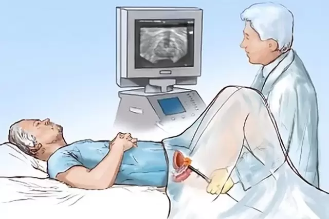 prostatito diagnozė